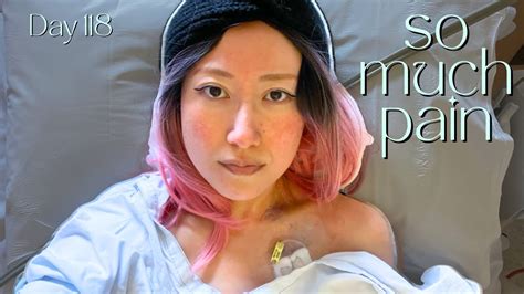 My Port Placement Surgery In Melbourne Breast Cancer Vlog Youtube