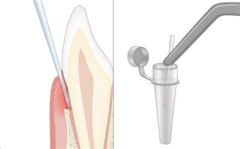 Perio Tools O Seu Portal Online Para Ferramentas Periodontais