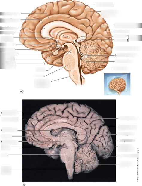 BIO 205 Midsection Of Brain Diagram Exam 3 Diagram Quizlet