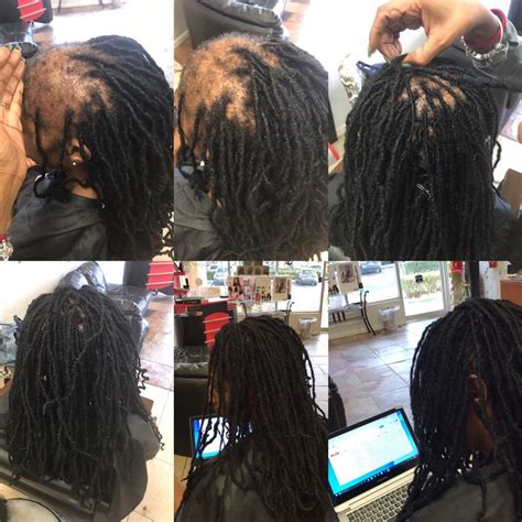 Dread Repair Natural Dreadlocks Locs Hairstyles Alopecia Hairstyles