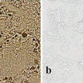 Regeneration Of Spermatogenesis After Busulfan Injection A Changes In