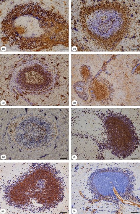 Heterogeneity Of Stromal Cells In The Human Splenic White Pulp