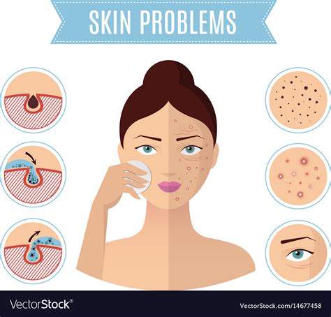 Skin Problem Solving Acne Treatment And Cleansing Vector Image