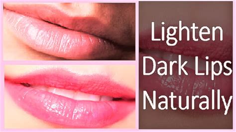 How To Get Rid Of Dark Lips Fast Lighten Dark Lips Naturally YouTube