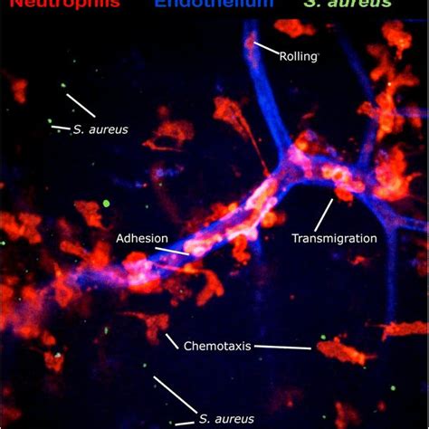 Neutrophil Extravasation Spinning Disk Intravital Microscopy Image