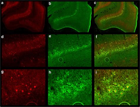 Perineuronal Nets Surround Parvalbumin Positive Interneurons Throughout