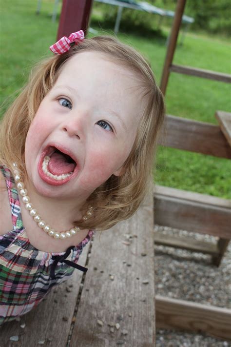 Famous Celebrities With Down Syndrome Syndrome Down Daughter Defined