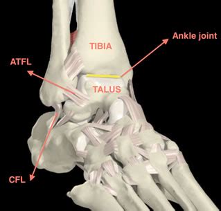 Anatomy Ligament Ankle Sprain