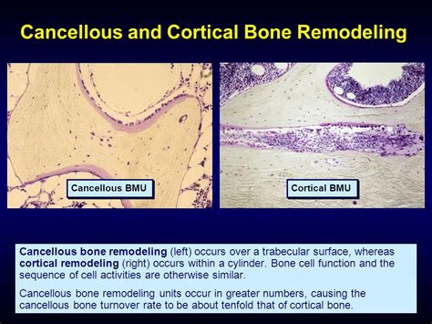 Cortical Bone Histology