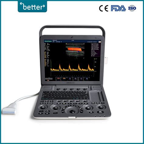 Full Digital Portable Ultrasound D Color Doppler Sonoscape S Exp