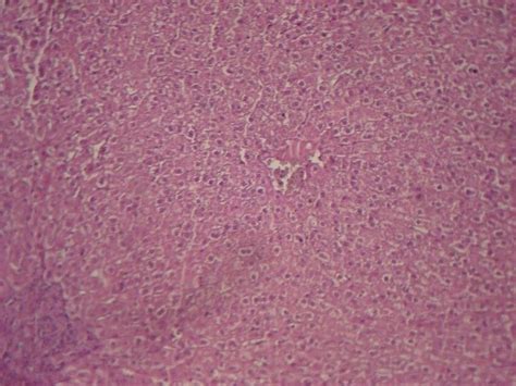 Histopathological Sections Of Rabbits Liver In Group A At 21 Days Post