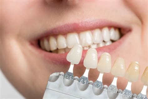 Transform Your Smile With Implants In Bulgaria A Complete Guide St