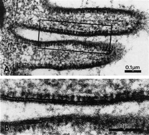 Cell Membrane Electron Micrograph