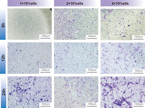 Frontiers Graphene Quantum Dots Promote Migration And Differentiation