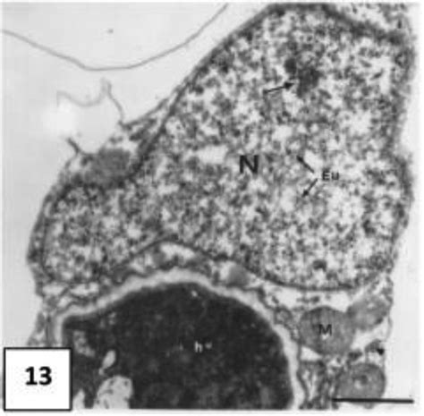 Tem Micrograph Of An Infected Mesophyll Cell Of S Aegyptius During The