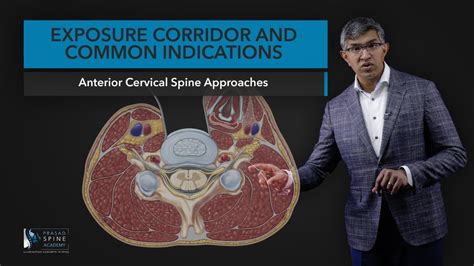 Anterior Cervical Spine Surgery Exposure Corridor And Common Indications Youtube