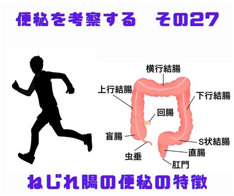 便秘を考察する その27 ねじれ腸の便秘の特徴 福岡天神内視鏡クリニックブログ