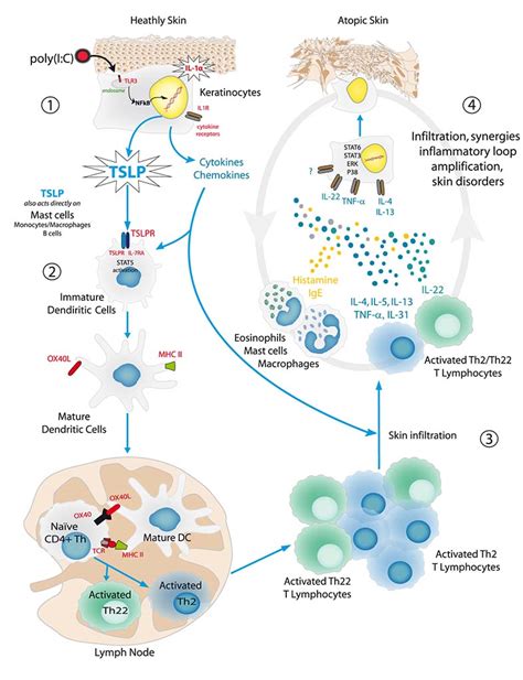 Tslp And Atopic Dermatitis Initiation And Chemokines Activation Step