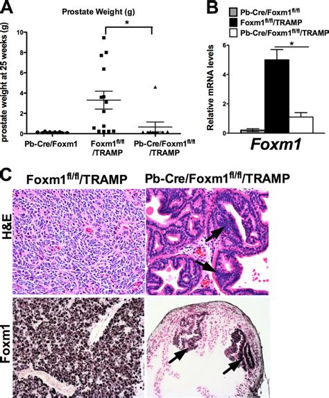 Deletion Of Foxm1 From Prostate Epithelial Cells Prevents Prostate