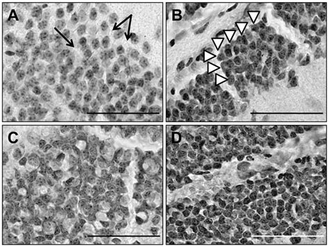 Organizational Differences In The Granule Cells Of The Dg Untreated