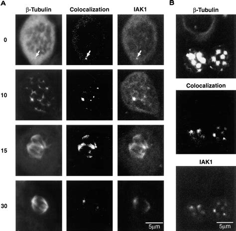 A Localization Of IAK1 In Nocodazole Treated Cells NIH 3T3 Cells