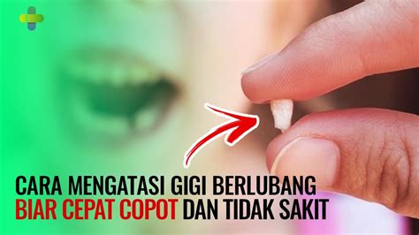 Cara Mengatasi Gigi Berlubang Biar Cepat Copot Dan Tidak Sakit Ll