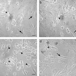 Ifn Protects Tg Cultured Cells From Cytopathic Effect Caused By Hsv