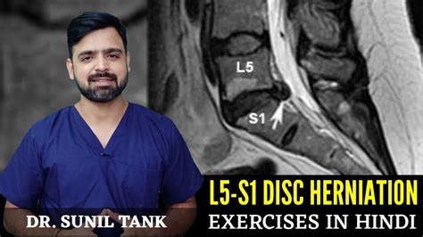 L L S Herniated Disc Exercises L L S Disc Bulge Treatment