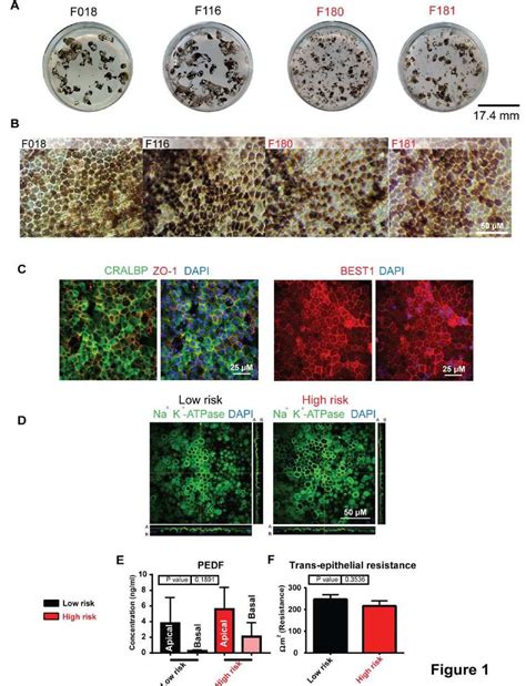 Derivation Of Amdipsc Rpe A Light Microscopy Images Of Ipscrpe