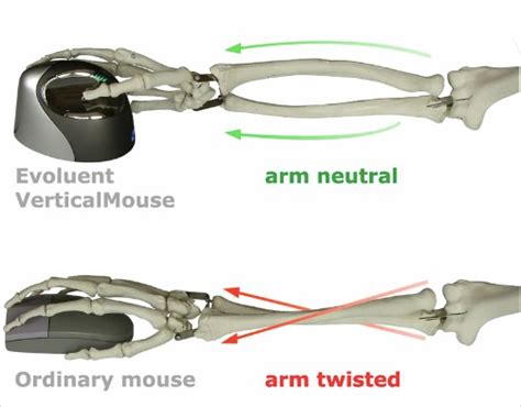 What S The Difference Between An Ergonomic Mouse And A Normal Computer