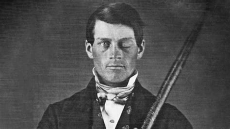 Phineas Gage El Extraordinario Caso Del Hombre Que Vivi Con Un