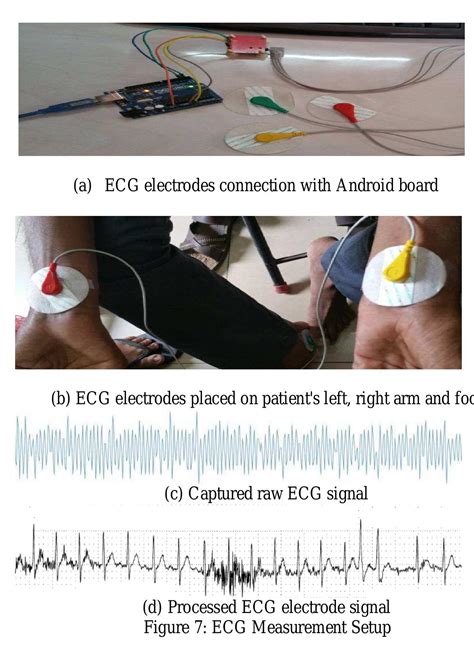 Pulse Oximetry Sensor Circuit Connection And Signal Response