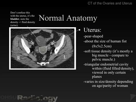 Female Pelvic Anatomy Ct Scan Human Anatomy