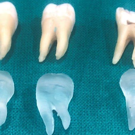 Comparison With Natural Tooth Figure Radiographic Assessment