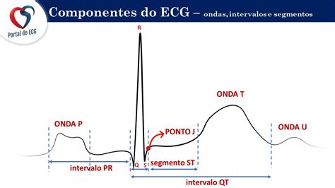 Passo A Passo Da Interpreta O Do Ecg Portal Do Ecg