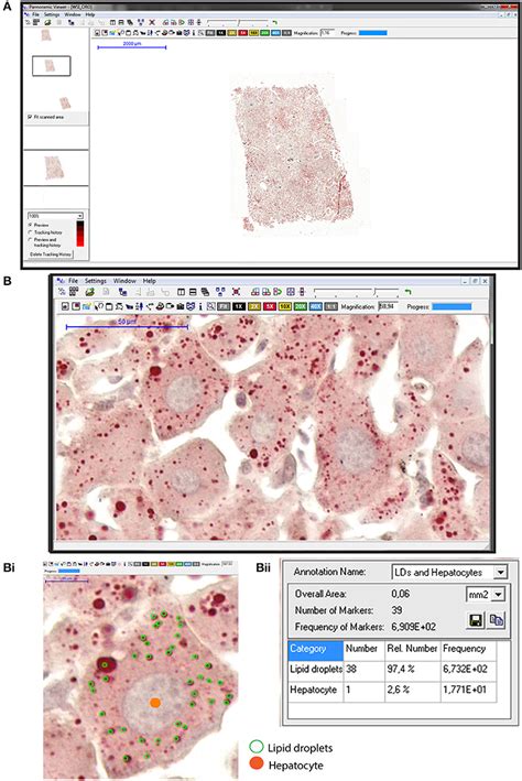 Frontiers Whole Slide Imaging And Its Applications To