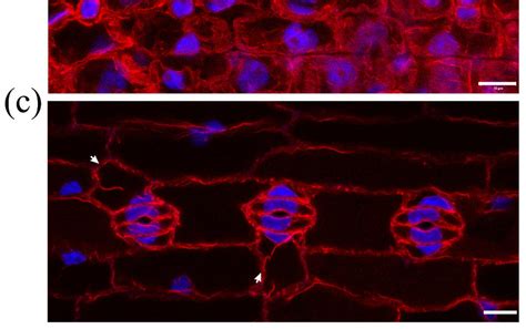 Maximum Projections Of Serial Clsm Sections Through Protodermal Leaf