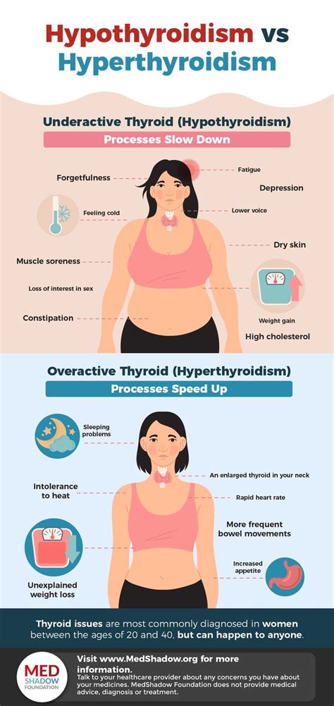 Overactive Thyroid Hyperthyroidism Disease Symptoms And 48 OFF