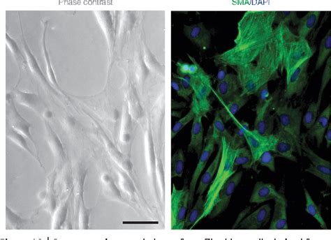 Figure From Derivation Of Neural Crest Cells From Human Pluripotent