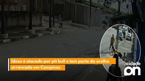 Idoso é atacado por pit bull e tem parte da orelha arrancada em