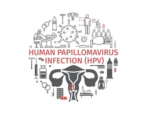 Human Papillomavirus Infection Hpv Vector Infographics Medical