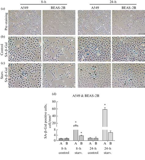 Effect Analysis Of The Level Of Senescence Activity After Glucose