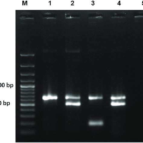 Agarose Gel 1 5 Showing Pcr Amplified Product From Positive Cpv