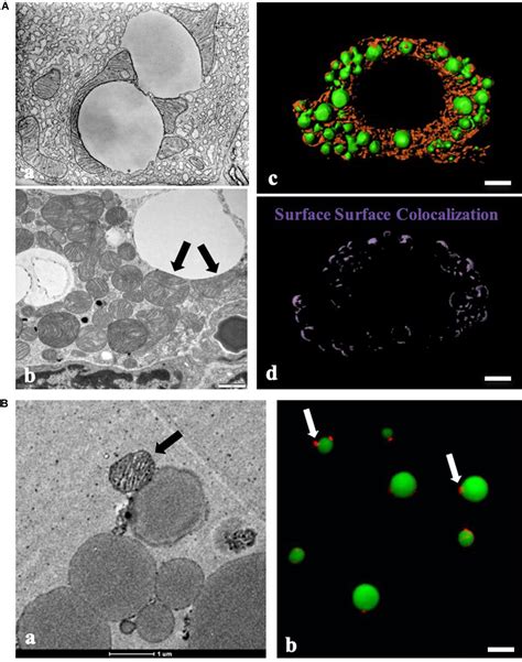 Frontiers Two Types Of Contact Between Lipid Droplets And Mitochondria