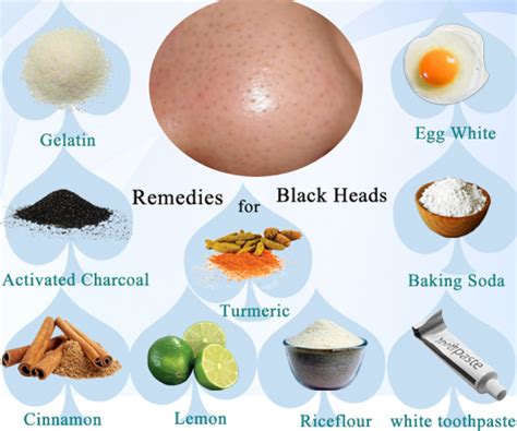 Want To Get Rid Of Blackheads 7 Easy And Simple Ways For You