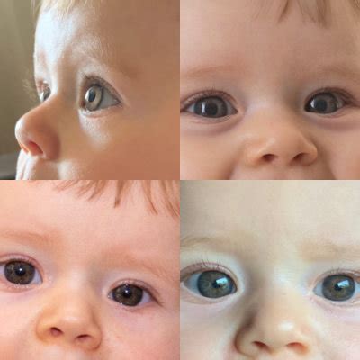 Cor Dos Olhos Mas Algum Beb Assim Babycenter