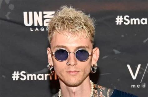 Did Machine Gun Kelly Have A Hair Transplant Hair System