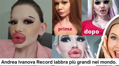 Andrea Ivanova Labbra Più Grandi Nel Mondo Il Record andrea YouTube