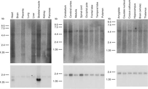 The Novel Neuronal Ceroid Lipofuscinosis Gene Mfsd8 Encodes A Putative