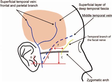 Distribution Of The Middle Temporal Vein And Landmarks Points C D E